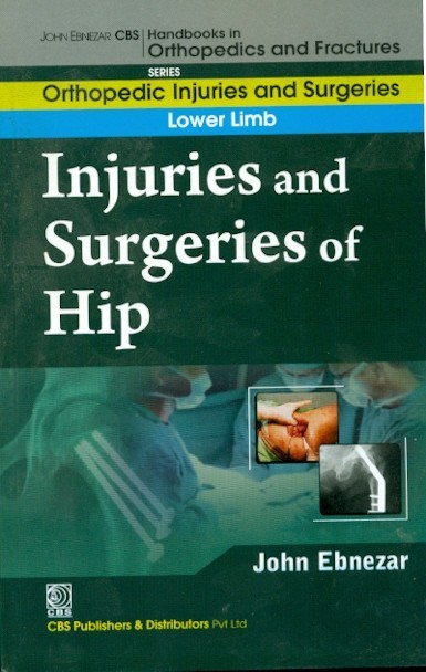 Injuries and surgeries of hip (handbooks in orthopedics and fractures series, vol. 55: orthopedic injuries and surgeries lower limb)