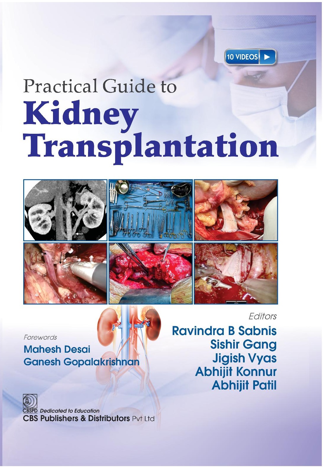Practical guide to kidney transplantation