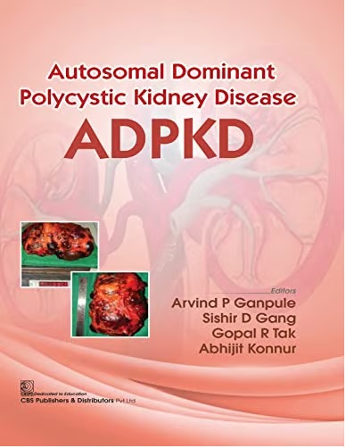 Autosomal dominant polycystic kidney disease adpkd