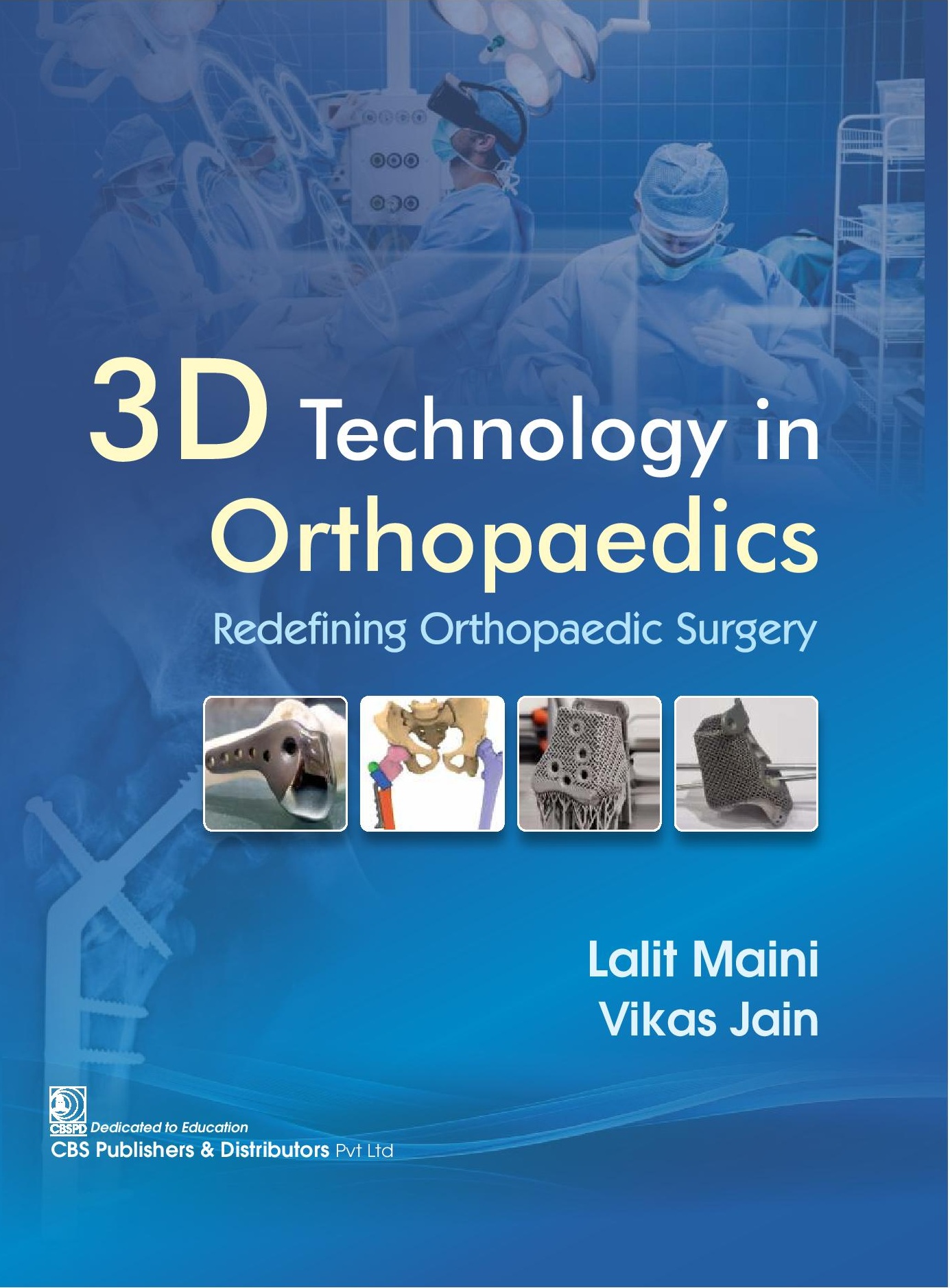 3d technology in orthopaedics redefining orthopaedic surgery