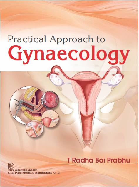 Practical approach to gynaecology