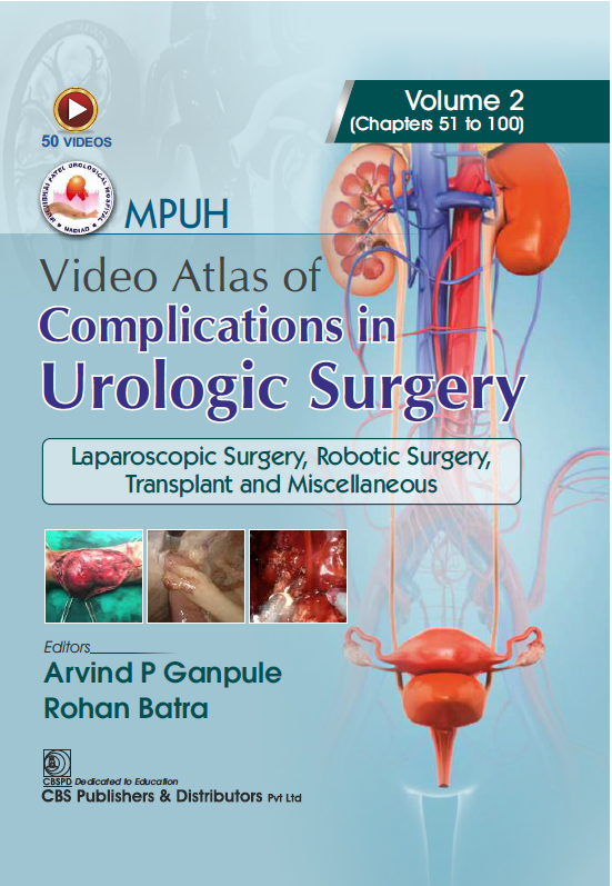 Mpuh video atlas of complications in urologic surgery, volume 2