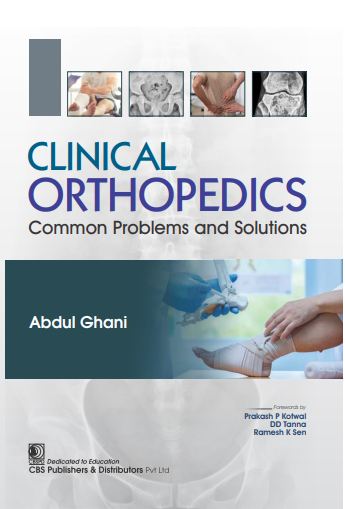 Clinical orthopedics common problems and solutions