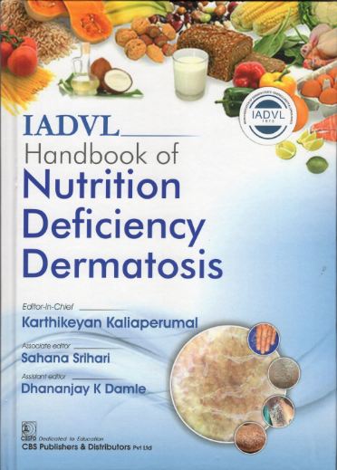 Iadvl handbook of nutrition deficiency dermatosis