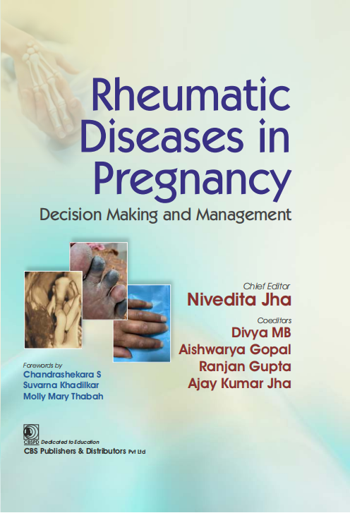 Rheumatic diseases in pregnancy decision making and management
