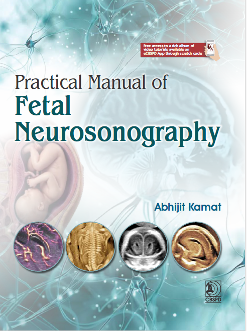 Practical manual of fetal neurosonography