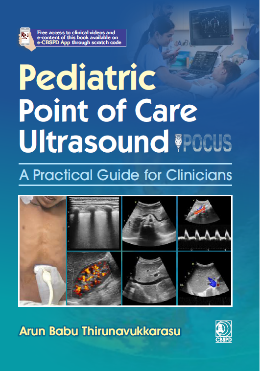 Pediatric point of care ultrasound: a practical guide for clinicians