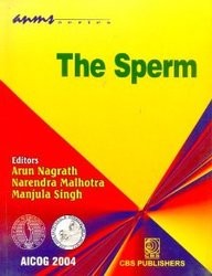 The sperm