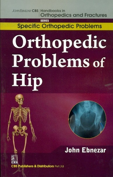 Orthopedic problems of hip (handbooks in orthopedics and fractures series, vol. 40: specific orthopedic problems)