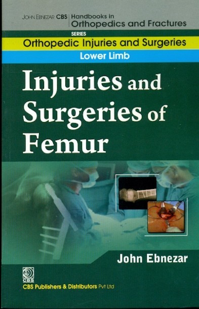 Injuries and surgeries of femur (handbooks in orthopedics and fractures series, vol. 56: lower limb)