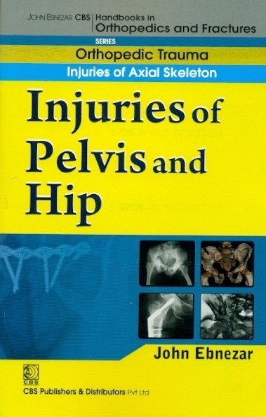 Injuries of pelvis and hip (handbook in orthopedics and fractures vol.20 - orthopedic trauma injuries of axial skeleton)