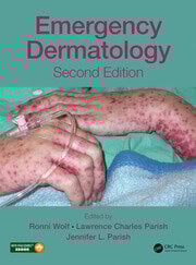 Emergency dermatology 2ed (hb 2017) 
