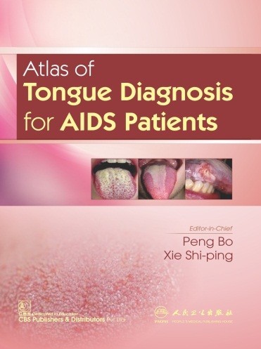 Atlas of tongue diagnosis for aids patients