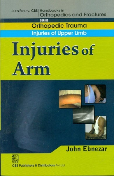 Injuries of arm ((handbook in orthopedics and fractures series, vol. 6 - orthopedic trauma injuries of upper limb)