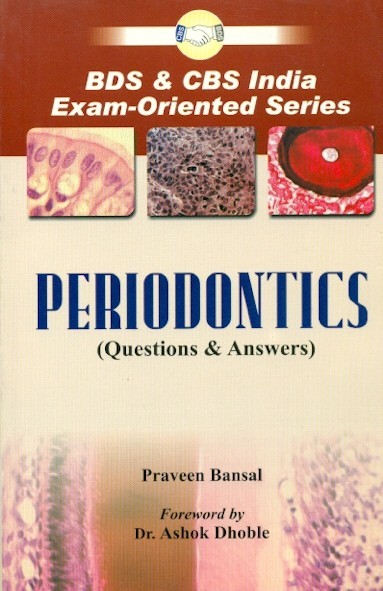 Periodontics (questions & answers)
