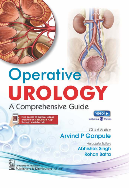 Operative urology: a comprehensive guide