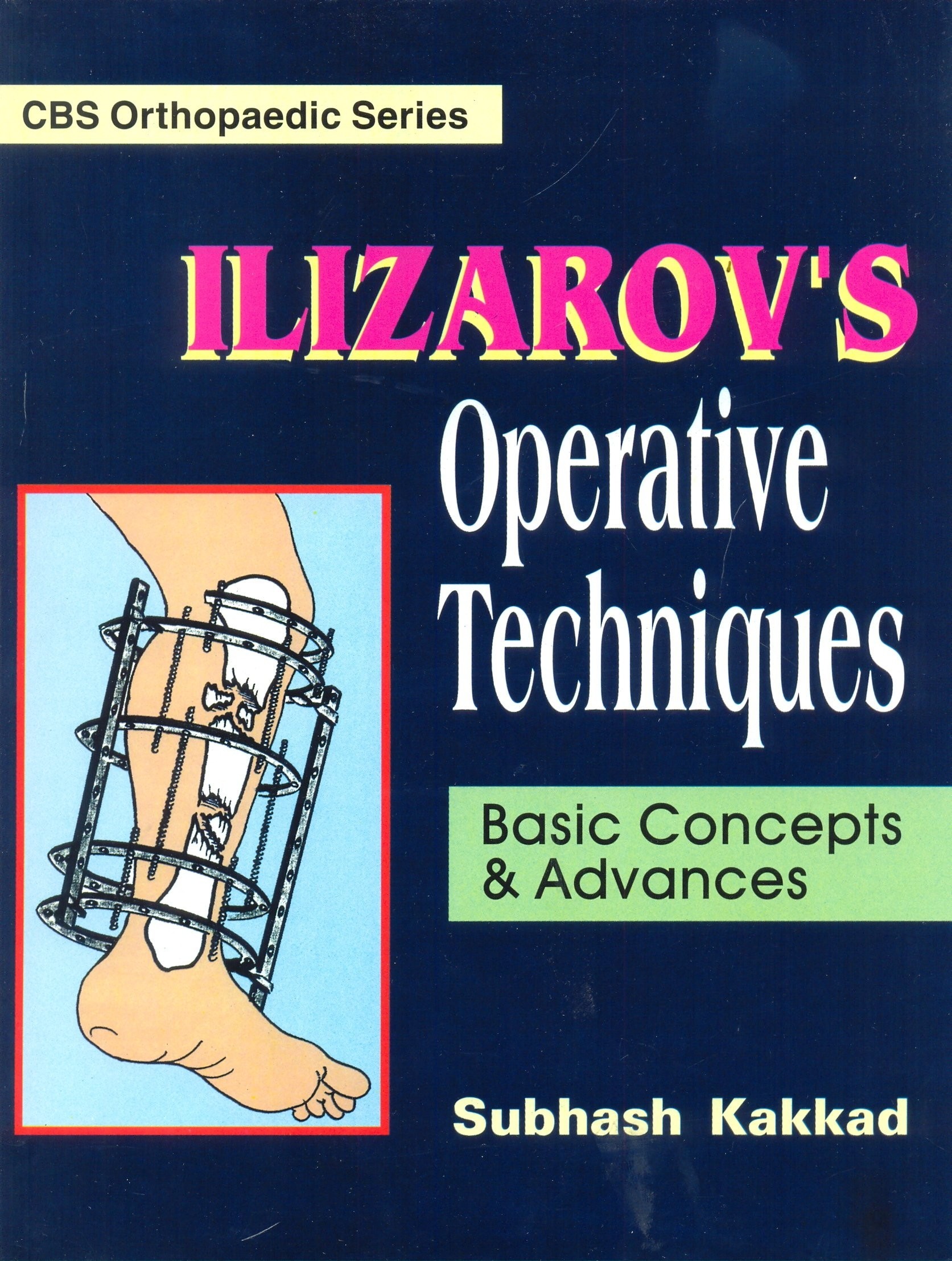 Ilizarov`s operative techniques: basic concepts and advances