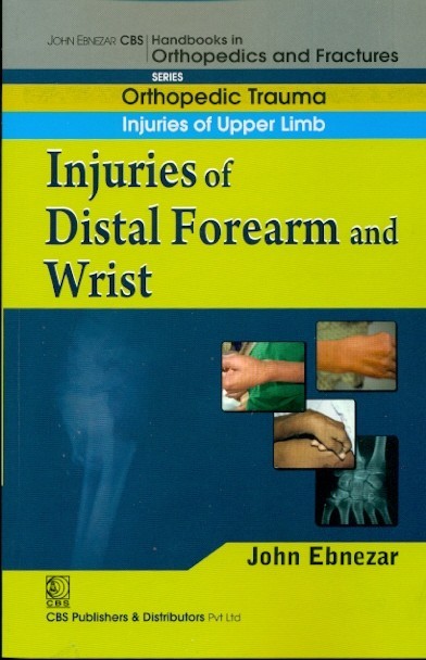 Injuries of distal forearm and wrist (handbook in orthopedics and fractures series, vol.10 - orthopedic trauma injuries of upper limb)