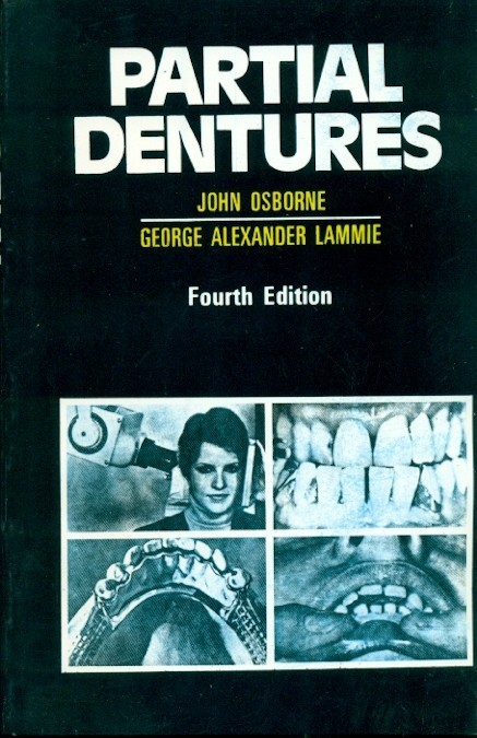 Partial dentures, 4e