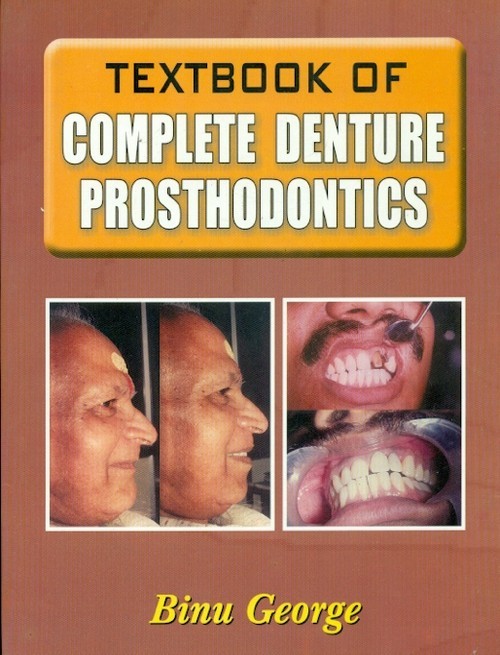 Textbook of complete denture prosthodontics