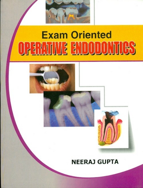 Exam oriented operative endodontics