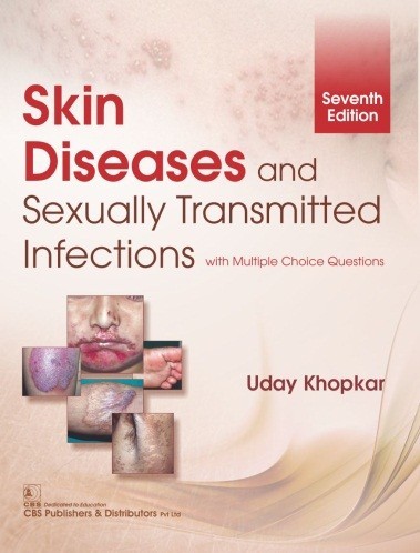Skin diseases and sexually transmitted infections, 7/e with multiple choice questions