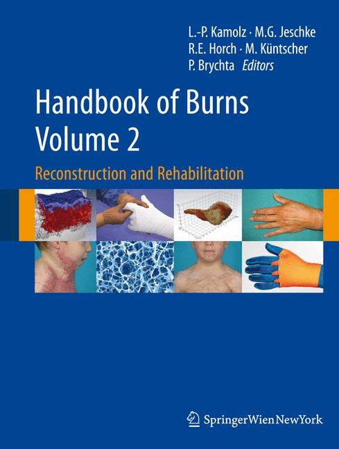 Handbook of burns volume 2: reconstruction and rehabilitation (vol.2)