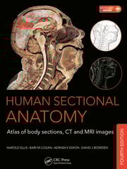 Human sectional anatomy atlas of body sections ct and mri images with access code 4ed (hb 2015) 