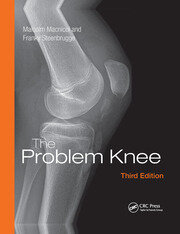 The problem knee 3ed (pb 2018)