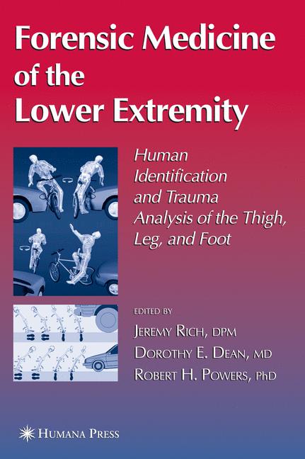 Forensic medicine of the lower extremity: human identification and trauma analysis of the thigh leg and foot