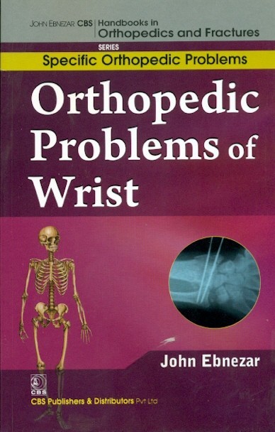 Orthopedic problems of wrist (handbooks in orthopedics and fractures series, vol 46: specific orthopedic problems)