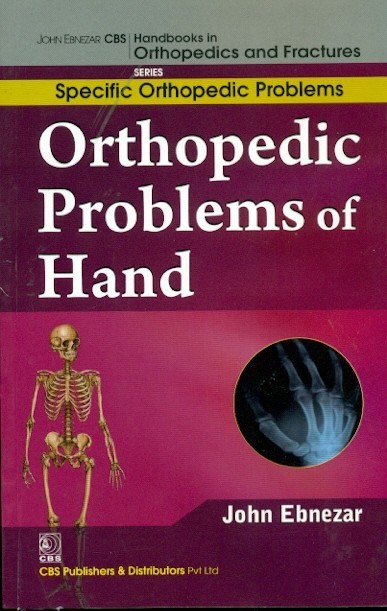 Orthopedic problems of hand (handbooks in orthopedics and fractures series, vol.47: specific orthopedic problems)