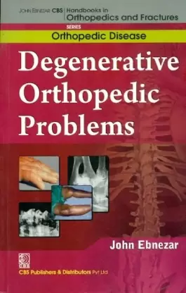 Degenerative orthopedic problems (handbooks in orthopedics and fractures series, vol35: orthopedic disease)ma)