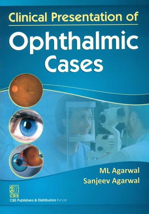 Clinical presentation of opthalmic cases (pb2014)