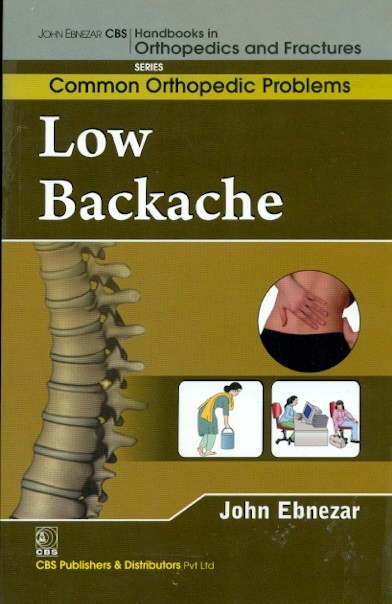 Low backache (handbooks in orthopedics and fractures series, vol. 86 common orthopedic problems )