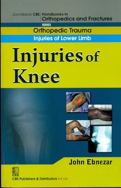 Injuries of knee (handbook of orthopedics and fractures series, vol. 15: orthopedic trauma injuaries of lower limb)