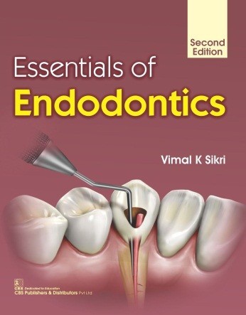 Essentials of endodontics