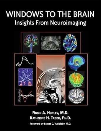 Windows to the brain insights from neuroimaging (hb 2008) 
