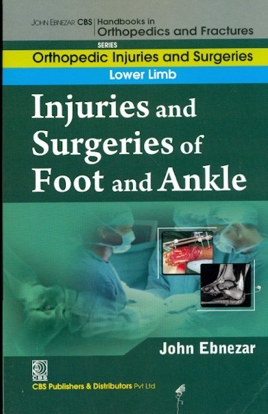 Injuries and surgeries of foot and ankle (handbooks in orthopedics and fractures series, vol. 58: orthopedic injuries and surgeries lower limb)