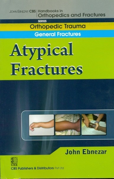 A typical fractures (handbook in orthopedics and fractures vol.4 - orthopedic trauma general fractures)