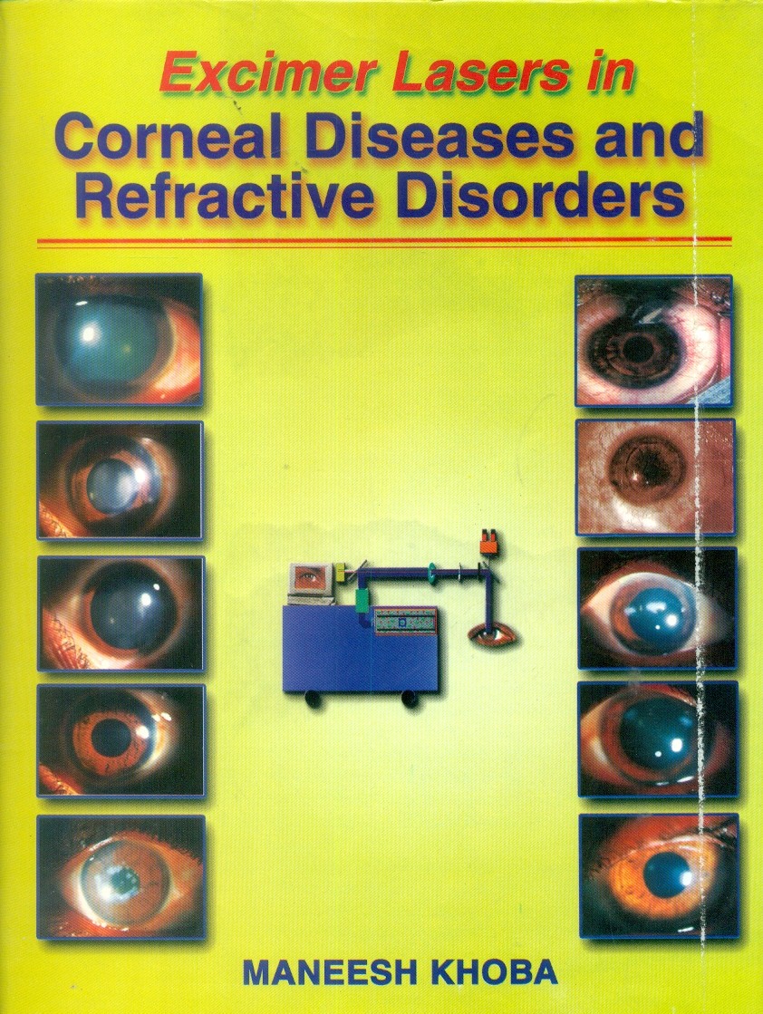 Excimer lasers in corneal diseases & refractive disorders