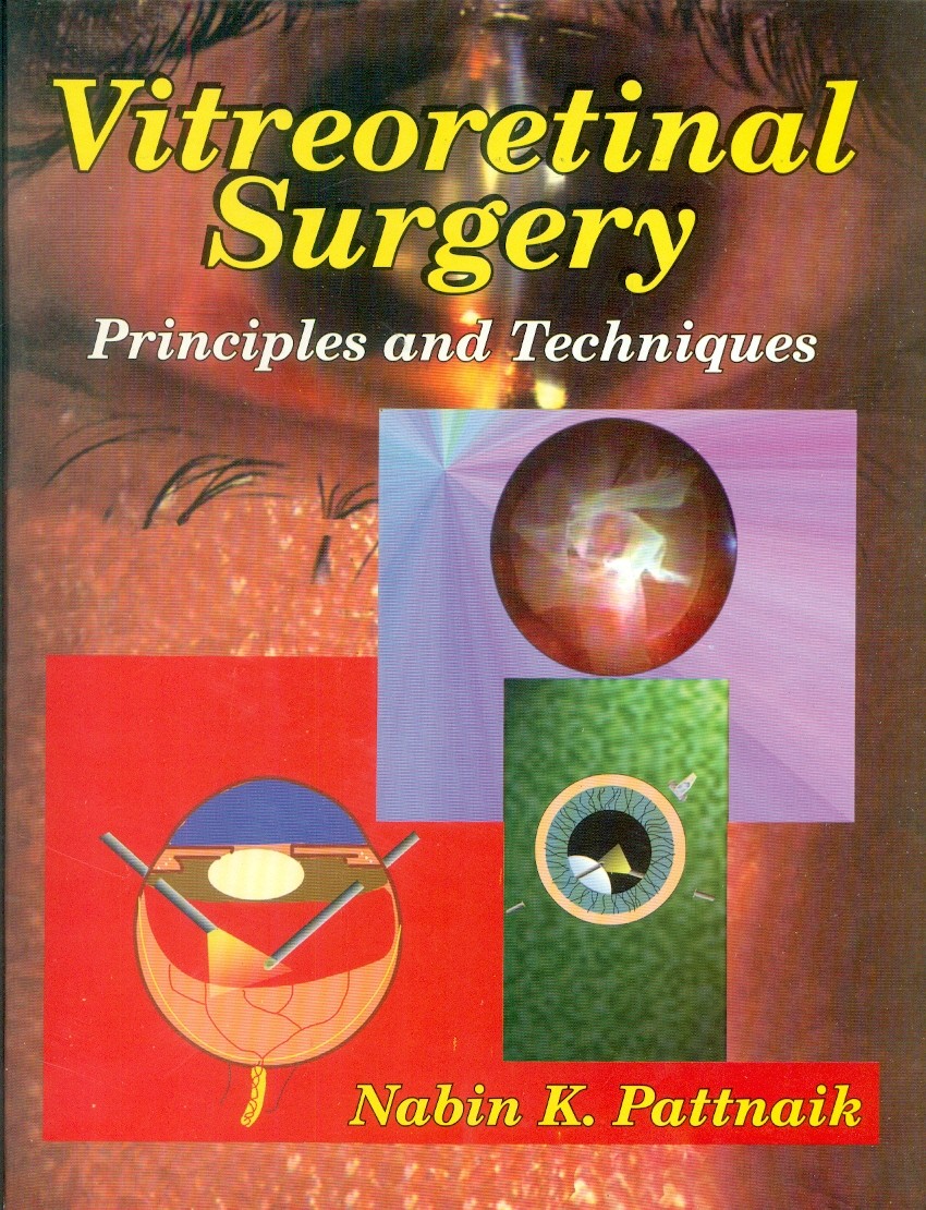 Vitreoretinal surgery: principles and techniques