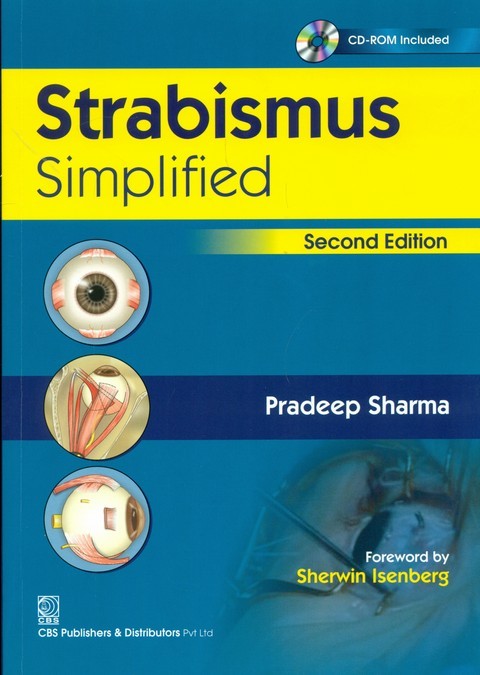 Strabismus—simplified
