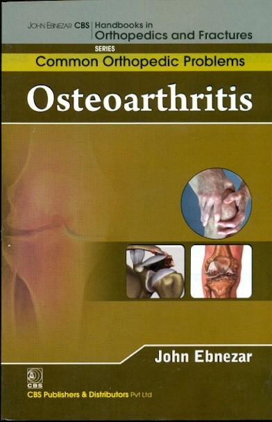 Osteoarthritis (handbooks in orthopedics and fractures series, vol. 87 -common orthopedic problems)