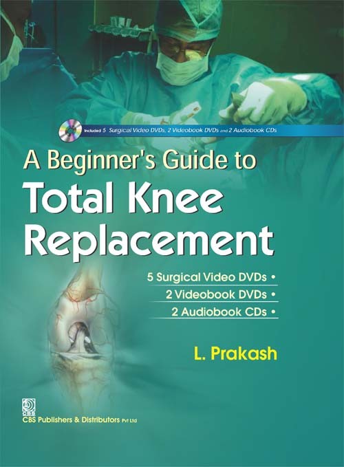 A beginners guide to total knee replacement