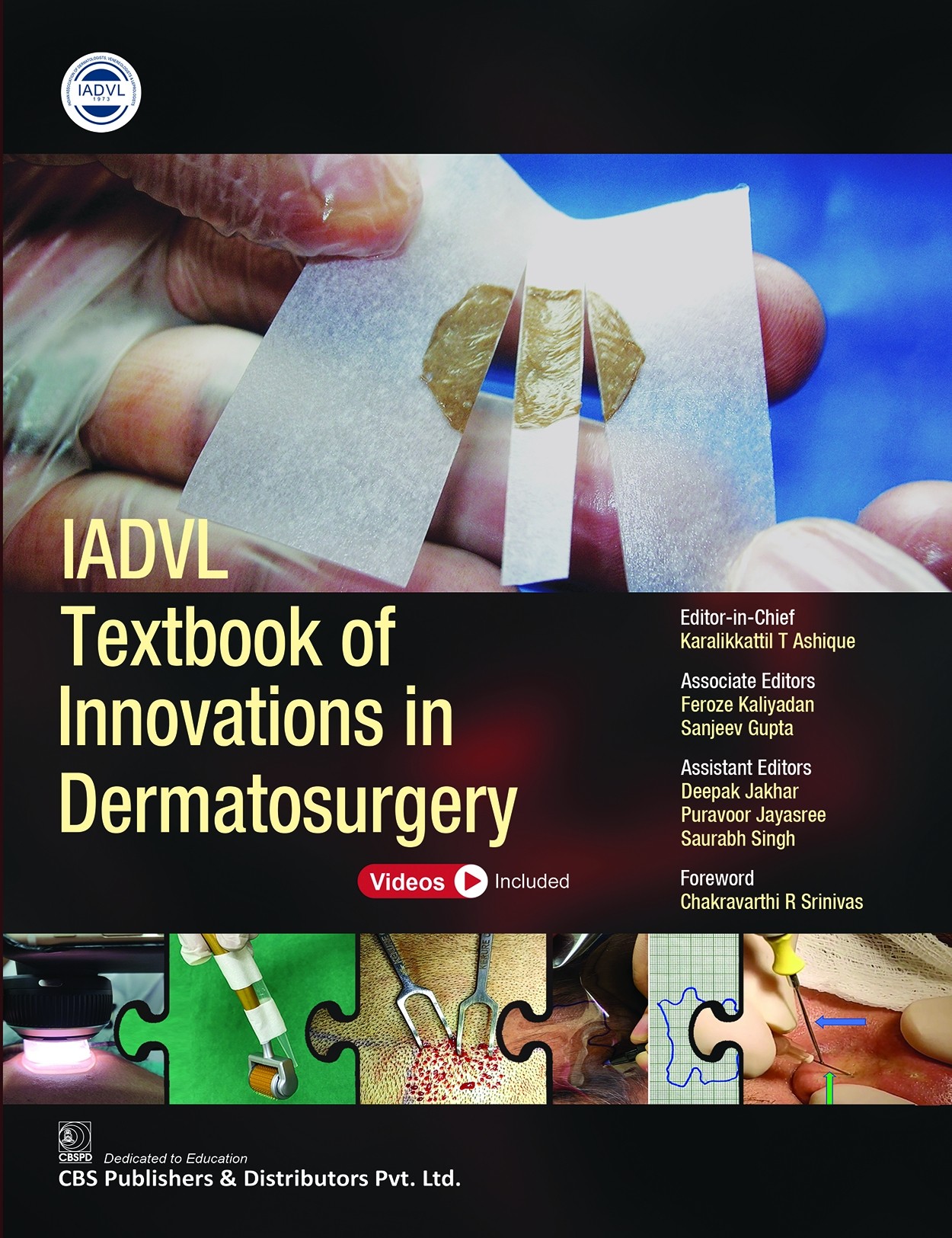 Iadvl textbook of innovations in dermatosurgery