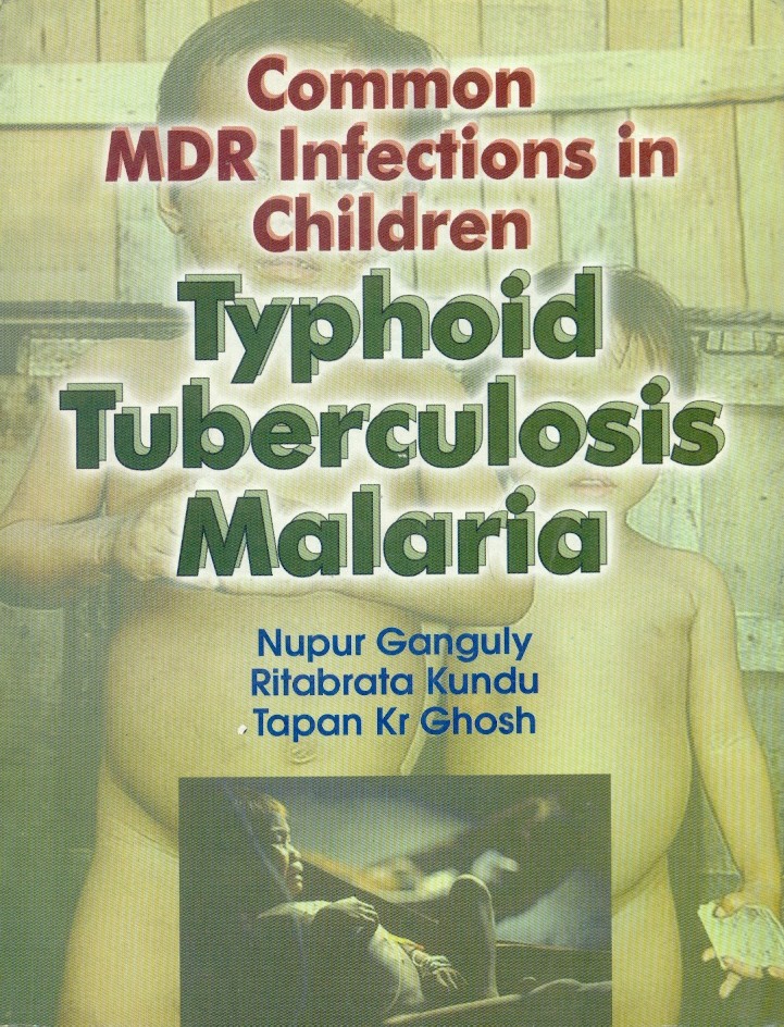 Common mdr infections in children typhoid tuberculosis malaria