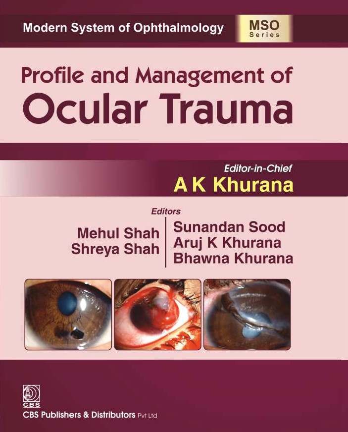 Modern system of ophthalmology (mso series): profile and management of ocular trauma 
