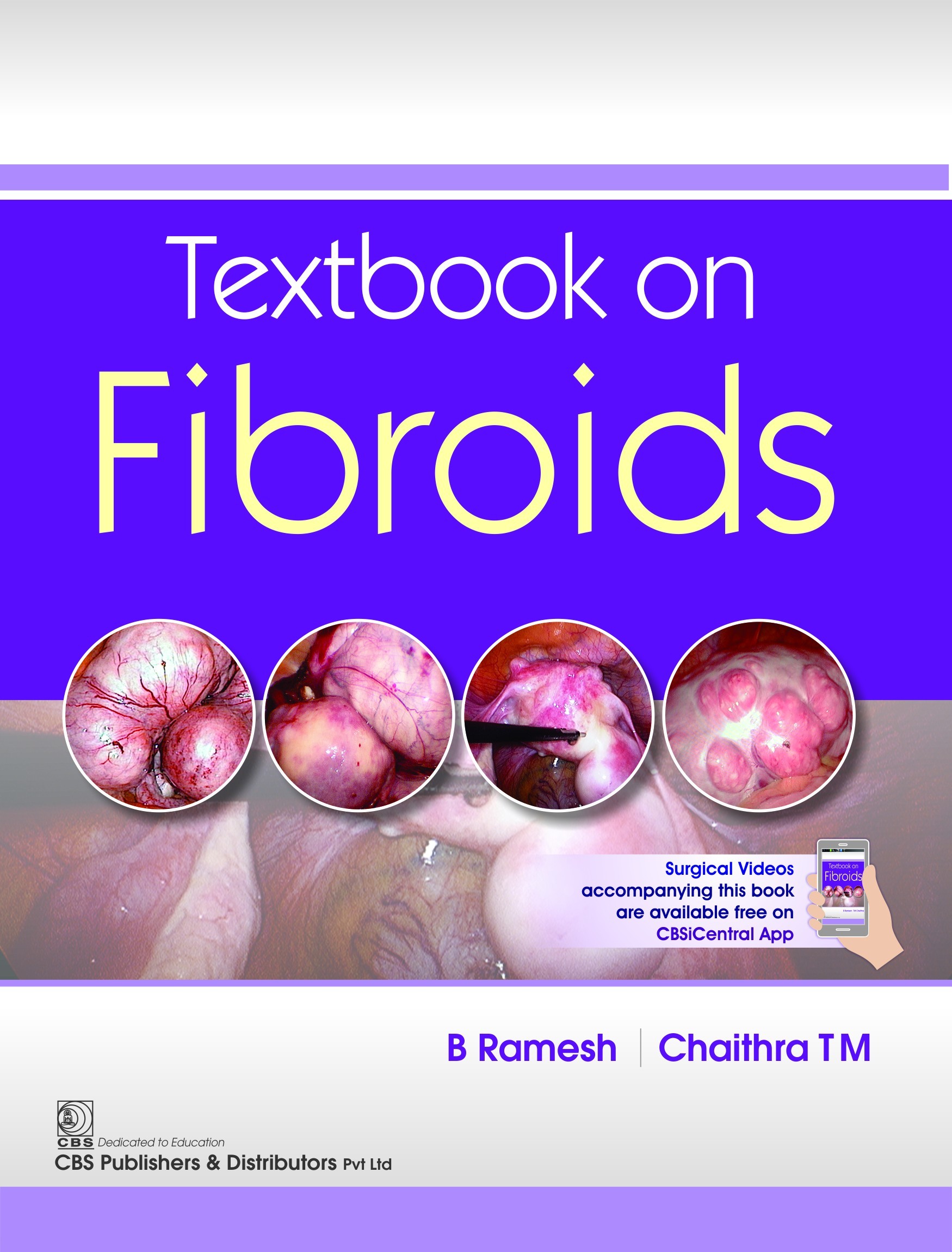 Textbook on fibroids
