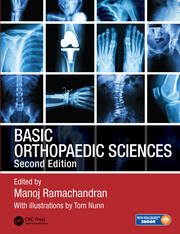 Basic orthopaedic sciences 2ed (pb 2017) 